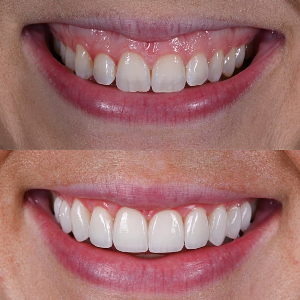 Images Nashville Wisdom Teeth and Implant Solutions