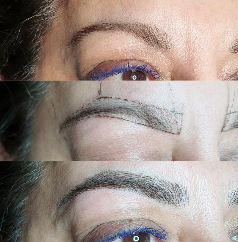 Images Centro De Estética Avanzada Y Láser Verónica Vico