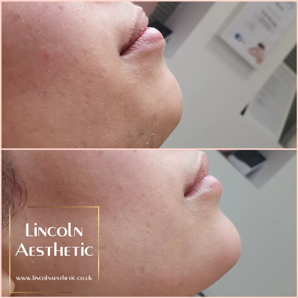 Images Lincoln Aesthetic