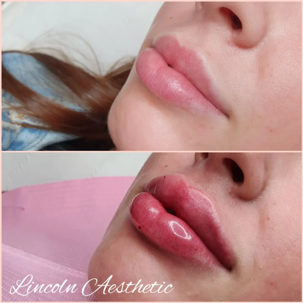 Images Lincoln Aesthetic