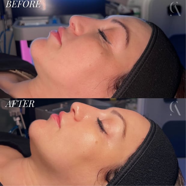 Images Corinne Aesthetics | Laser & Skin