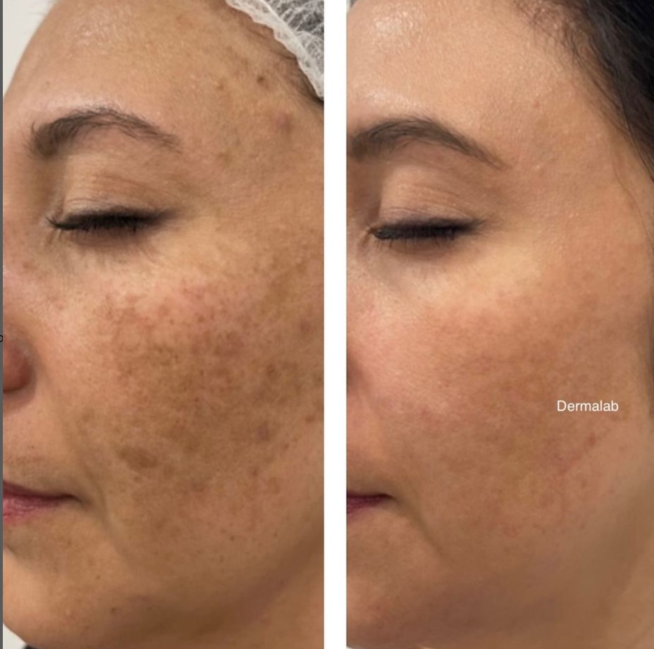 Images Dermalab