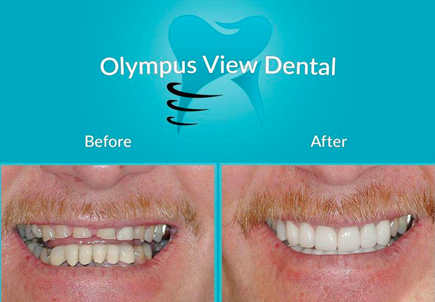Images Olympus View Dental