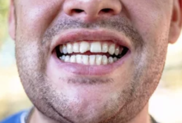 Images Emergency Dental of Dayton