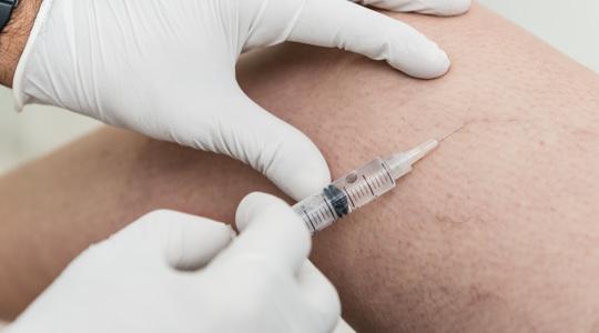 Sclerotherapy