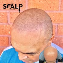 Images The Scalp Master