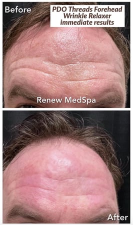 Images Renew Body Contouring & MedSpa