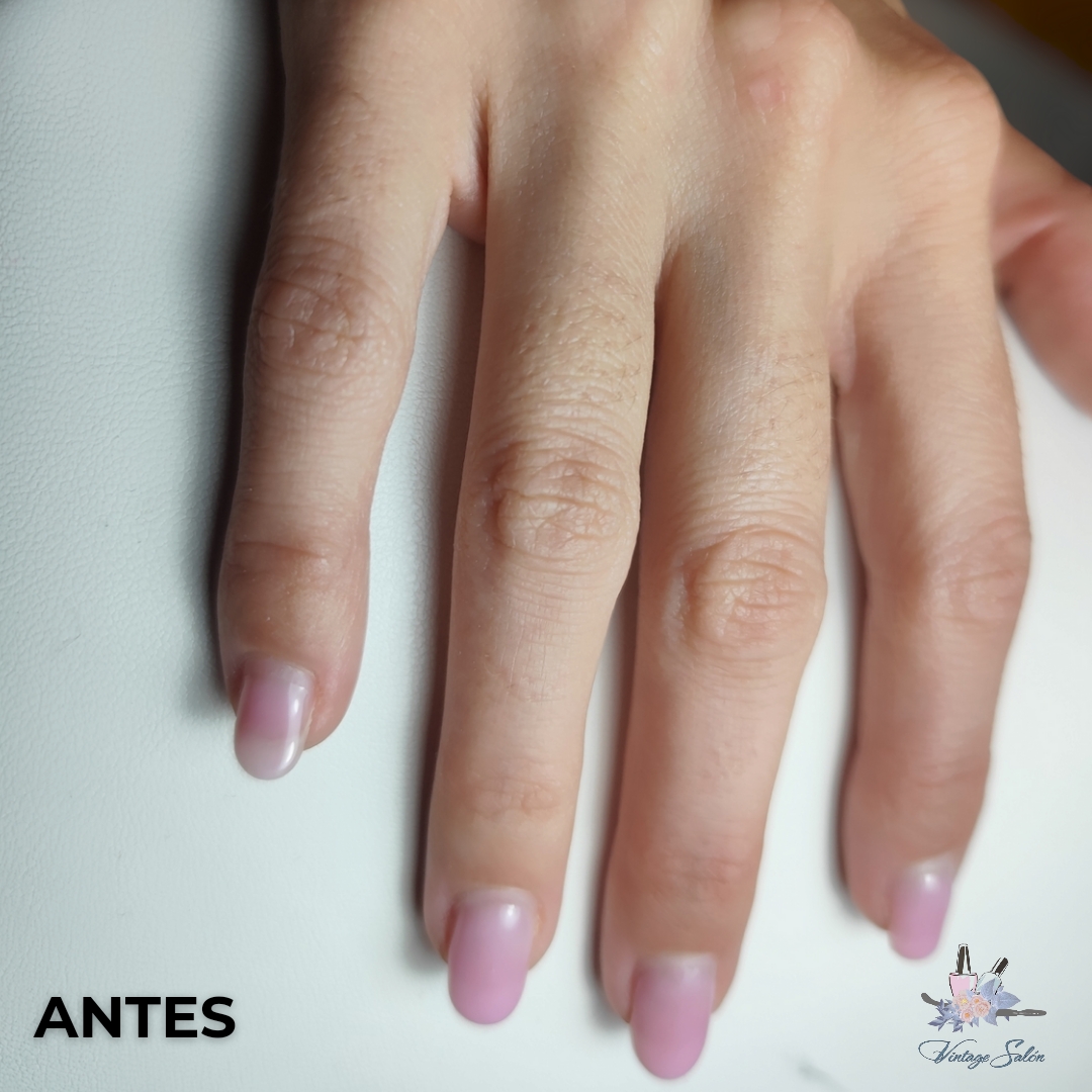 Images Fv Láser Nails Beauty