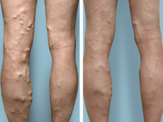 Images Metro Vein Centers | Clear Lake
