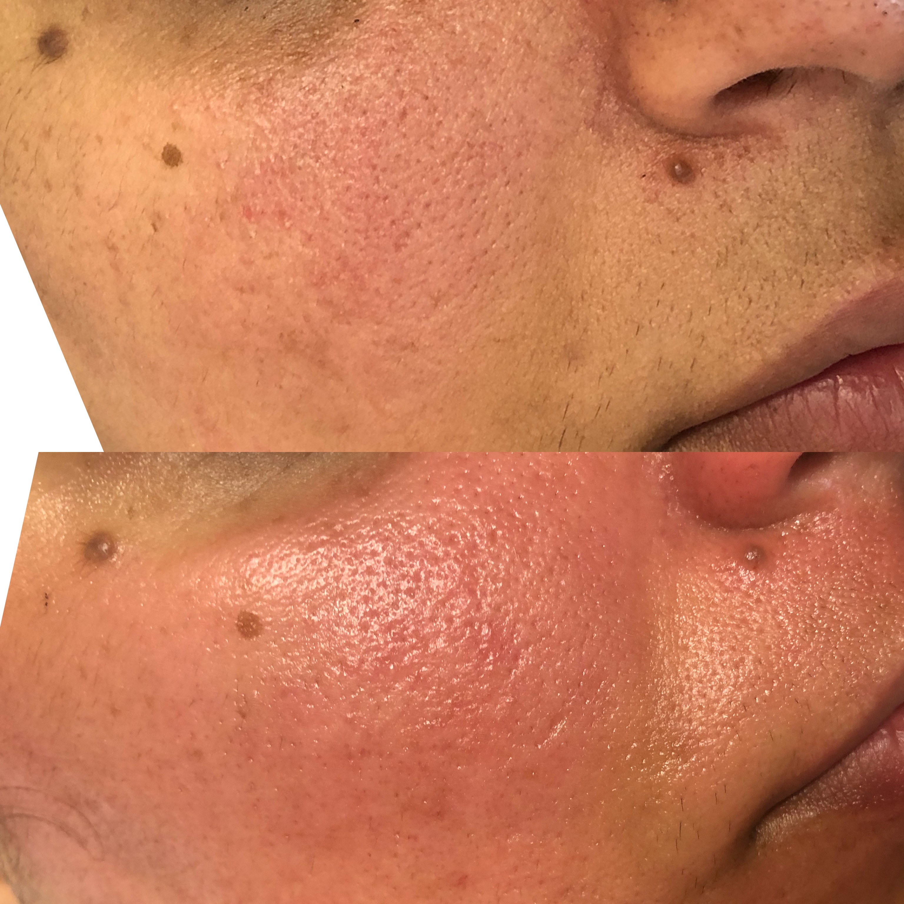 Images Clinique d'Esthétique Leila - Hydrafacial, Microblading, Épilation Laser Sainte-Foy