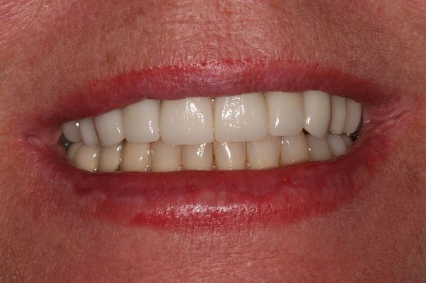 Images Aaron A. Leishman DMD, PA