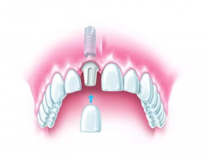 Images Moira Dental Care