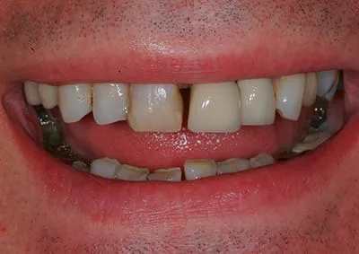 Images Smile Dental Laboratory