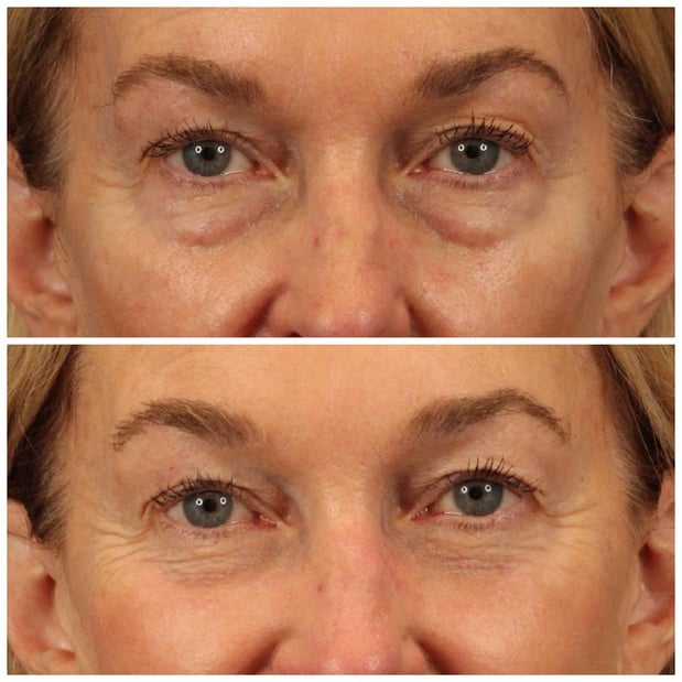 Images Dr. Sumit Bapna, MD