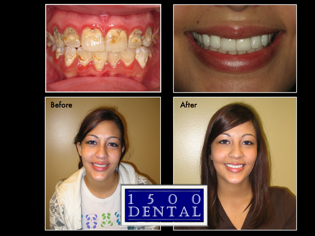 Images 1500 Dental