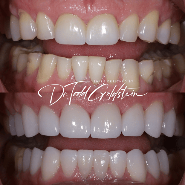 Images The Smile Aesthetic