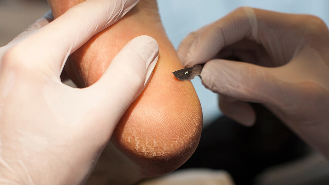 Images Klinik for fodterapi Mia Johansen