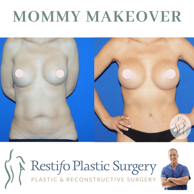 Images Restifo Plastic Surgery