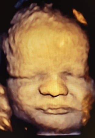 Images Love At First Sight 3D/4D Ultrasound Imaging Studio, LLC