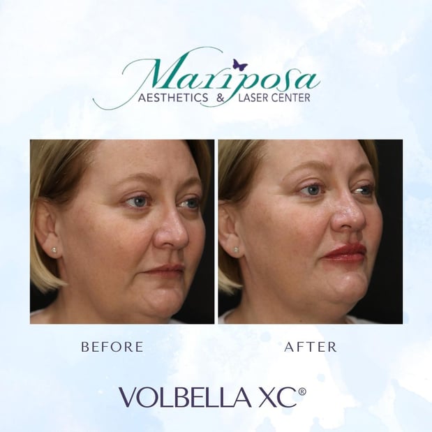 Images Mariposa Aesthetics & Laser Center