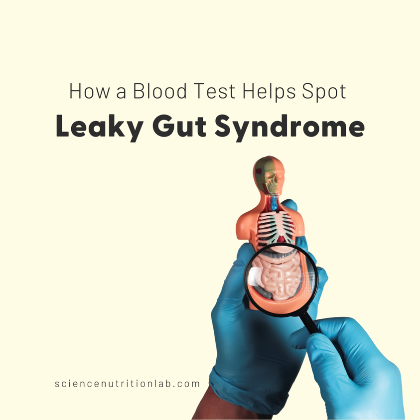 You may not think blood tests and gut health are closely connected. However, a single blood test can reveal crucial insight into gut health. Discover how a blood test helps spot leaky gut syndrome.