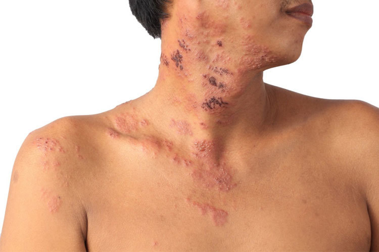 Images SPØR SYKEPLEIEREN HÅVARSTEIN