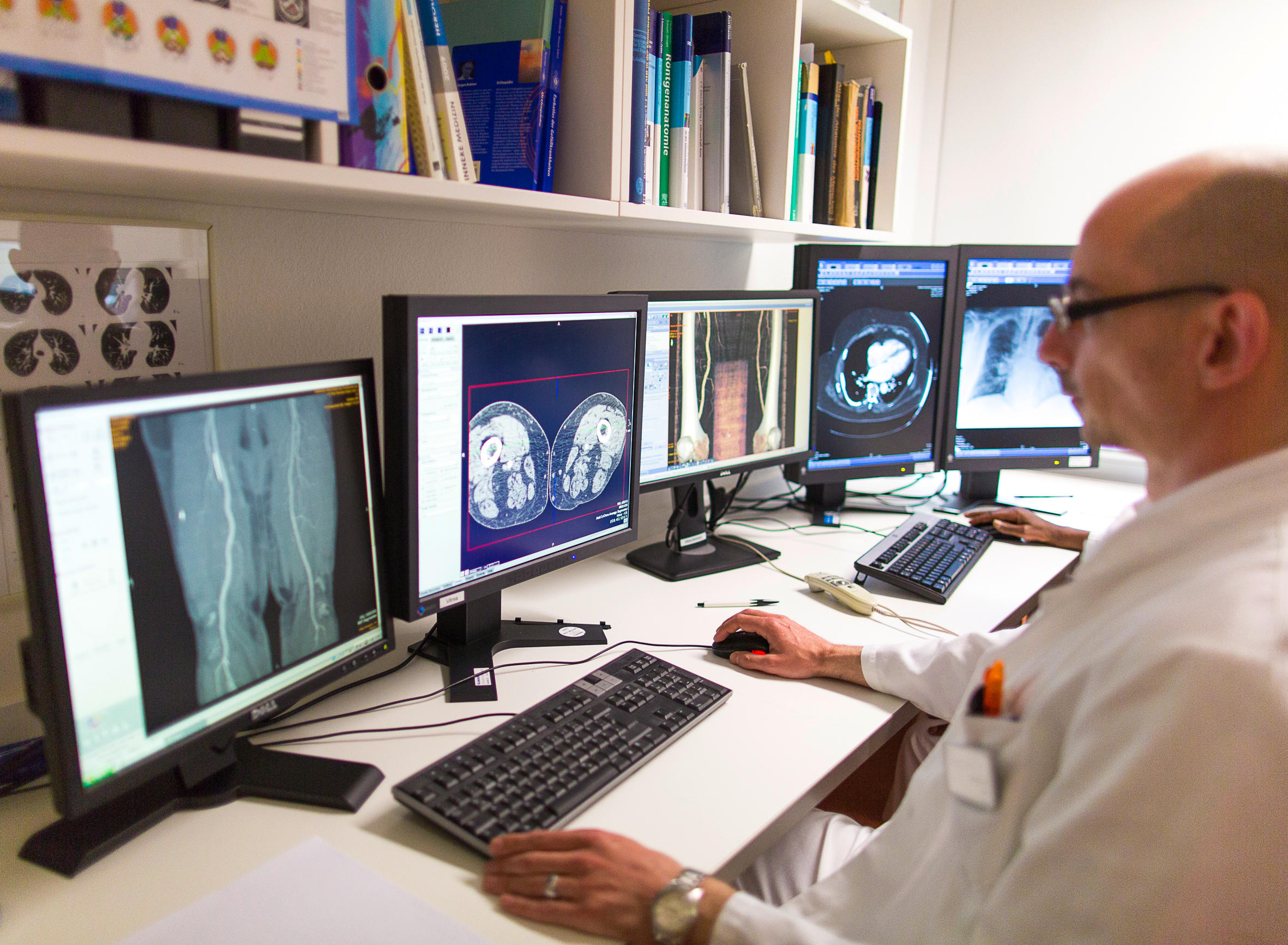 Ein Radiologe untersucht Röntgenbilder am Bildschirm.