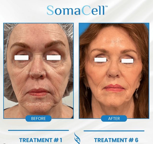 Images SomaCell
