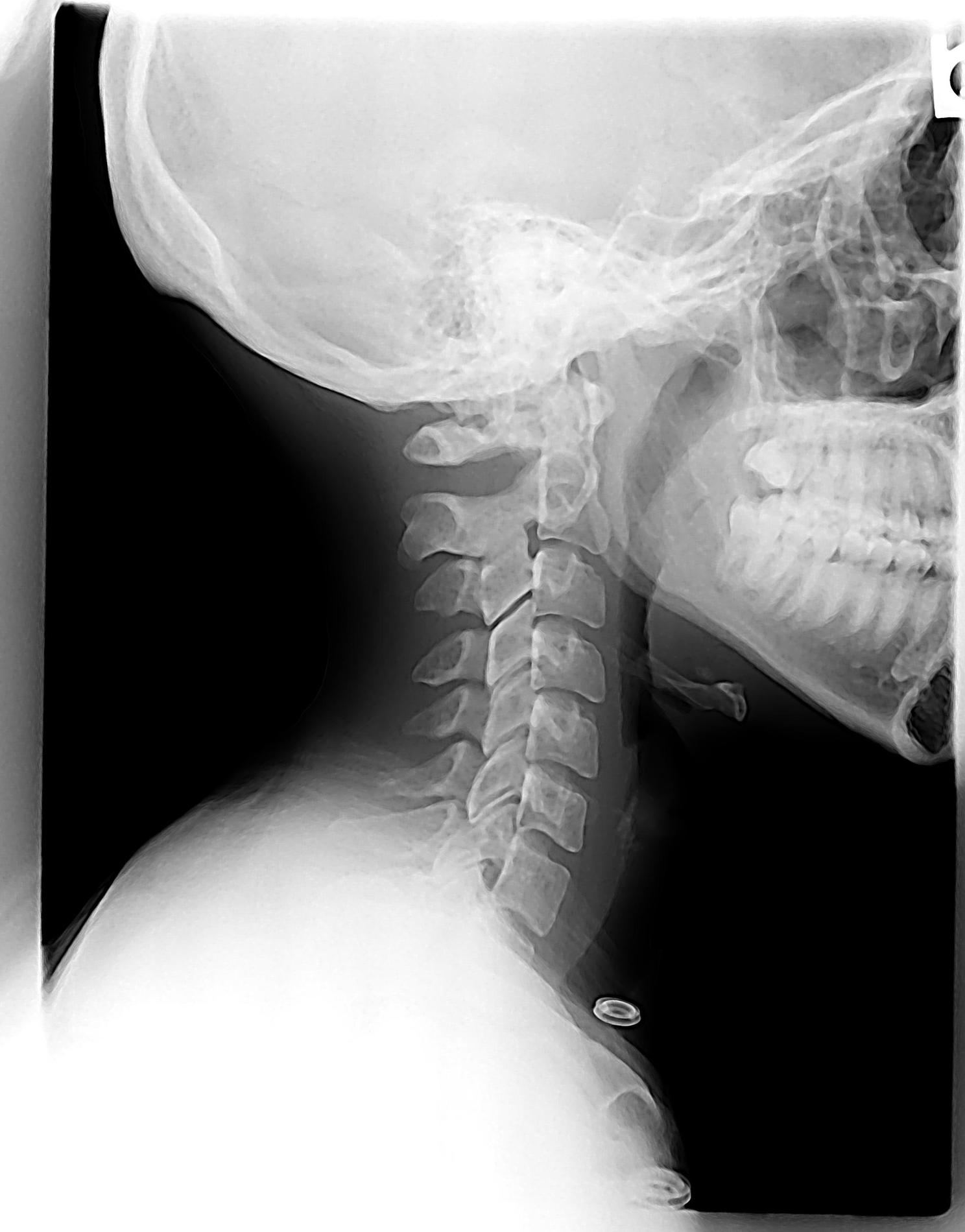 Images Fiorini Chiropractic Center, P.A.