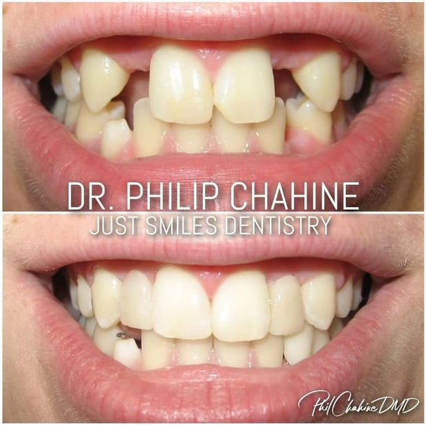 Images Just Smiles - General, Cosmetic & Implant Dentistry
