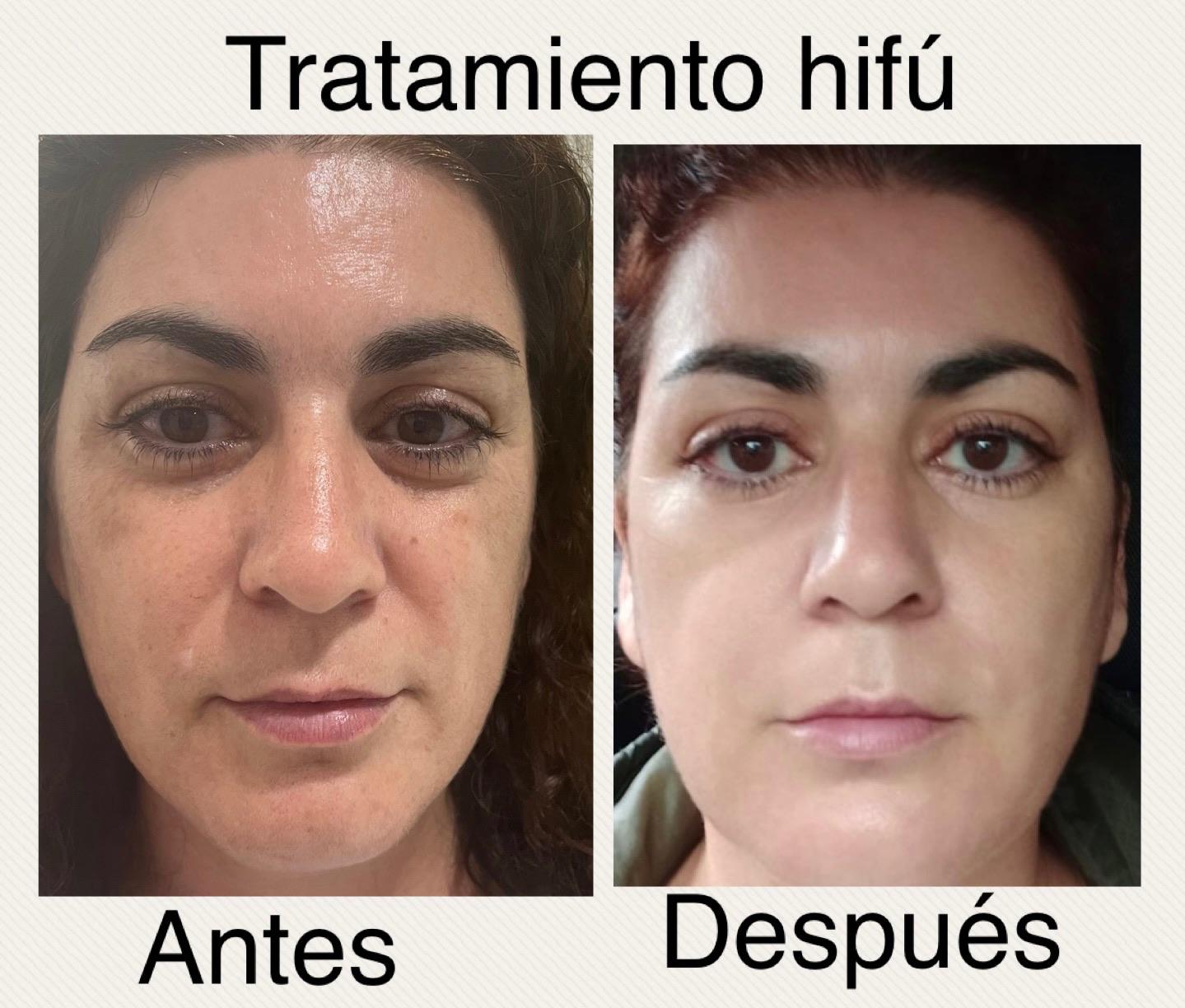 Images Centro De Estética Avanzada Y Láser Verónica Vico
