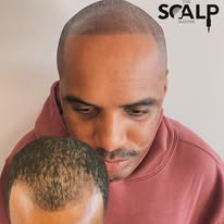 Images The Scalp Master