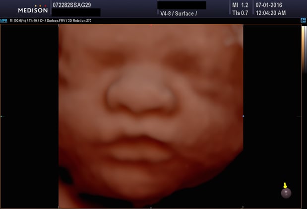 Images Heavenly 3D 4D Ultrasounds