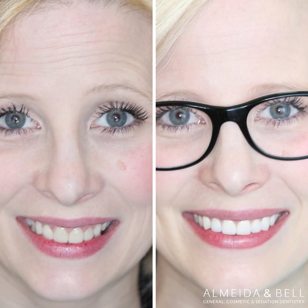 Images Almeida & Bell Dental Lone Tree - General, Cosmetic, and Implant Dentistry