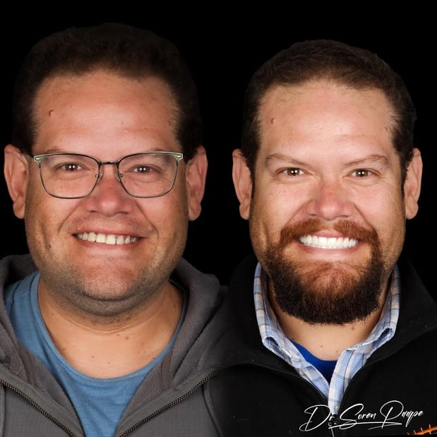 Images Smile Now Denver Dentures and Implants