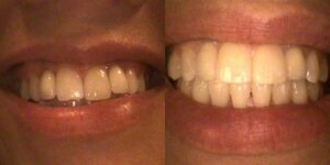 Images Haws Family Dentistry