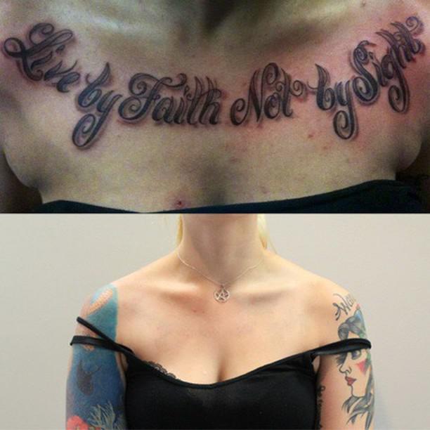 Removery Tattoo Removal & Fading à Ottawa: Before & After Chest Tattoo Removal
