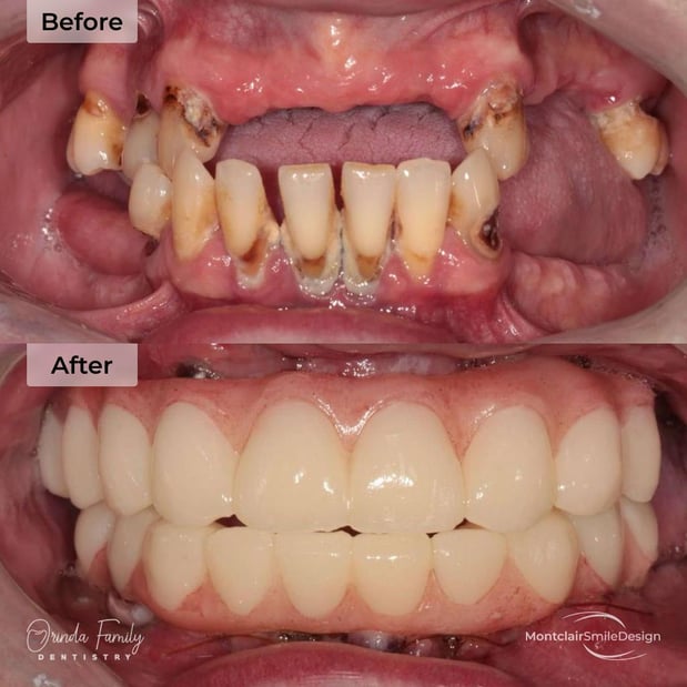 Images Orinda Family Dentistry