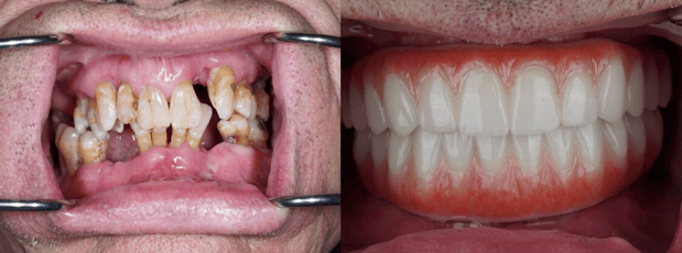 Images Eleve Cosmetic & Implant Center