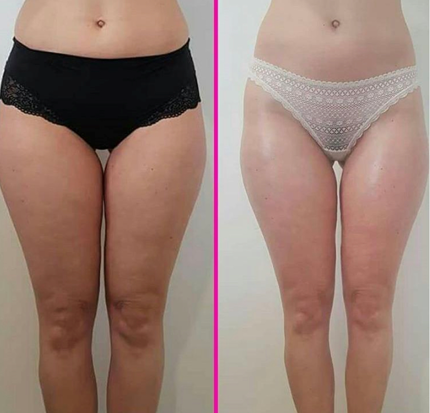 Vacuum Fit 100, Ackerstrasse 16 in Kloten