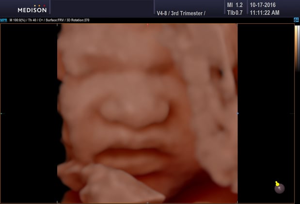 Images Heavenly 3D 4D Ultrasounds