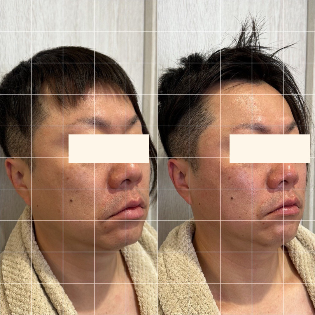Images アディス リティフル