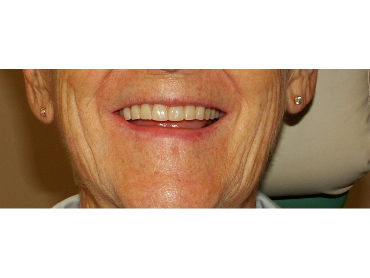 Images Mudgeeraba Denture Clinic