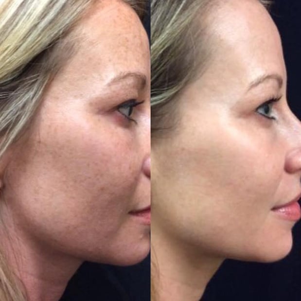 Images Gray Dermatology & Cosmetic Surgery