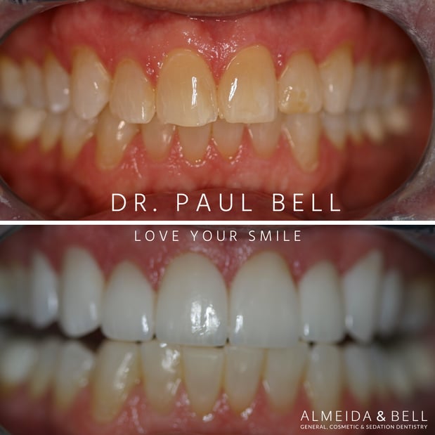Images Almeida & Bell Dental Lone Tree - General, Cosmetic, and Implant Dentistry