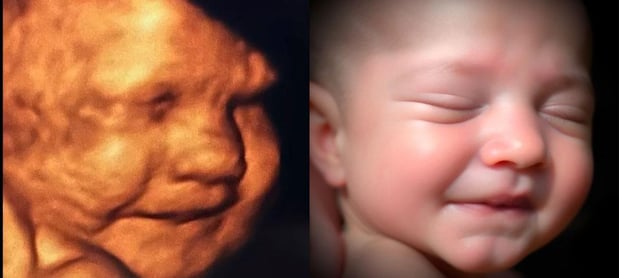 Images Chubby Cheeks 3D/4D Ultrasound Studio of Amarillo