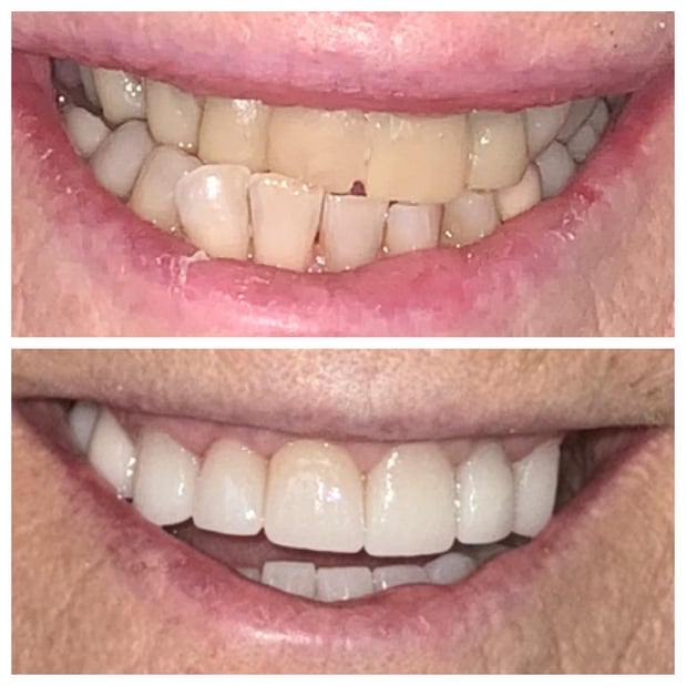 Images Summerlin Dental Solutions