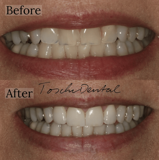 Images Toschi Dental: Steven M. Toschi, DDS and Jeffery Toschi, DMD