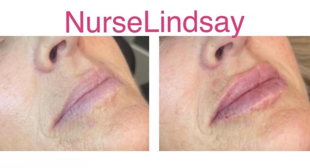 Images Central Coast Allure Medspa