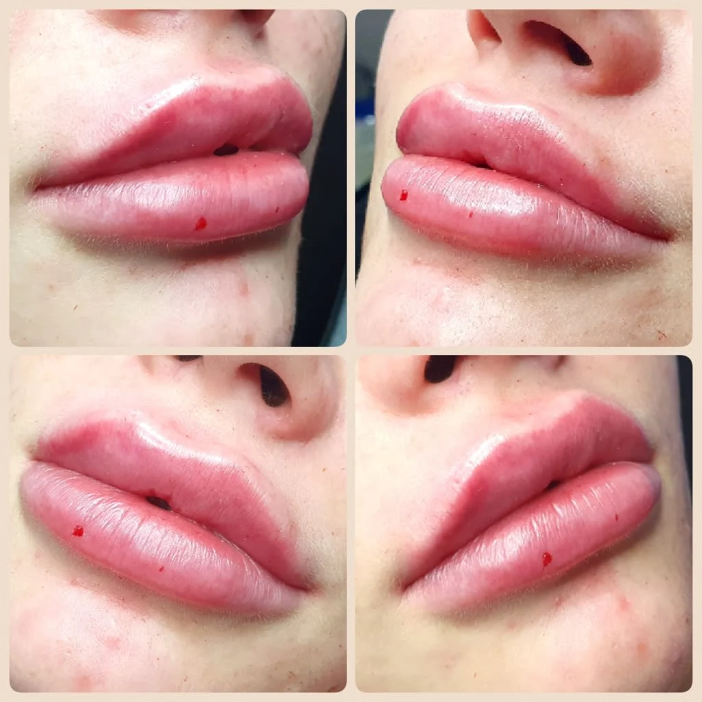 Images Lincoln Aesthetic